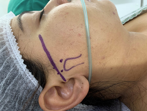 Rosto de pessoa com tatuagem no braço
Descrição gerada automaticamente com confiança baixa